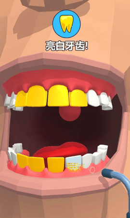 牙医也疯狂汉化版 1.0.1 安卓版